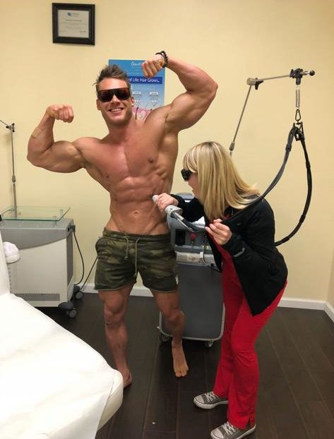 Laser Hair Removal for Bodybuilders